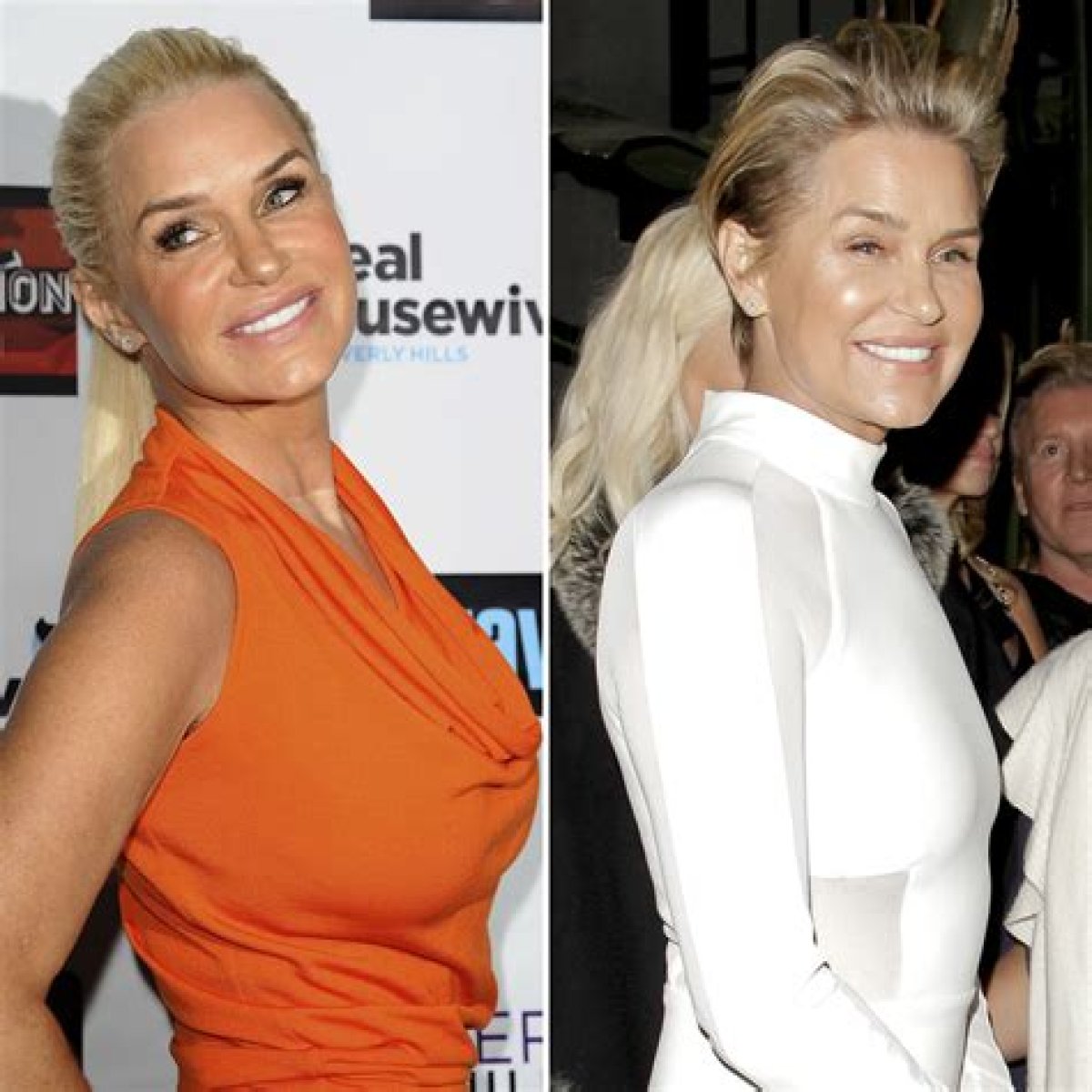 10 Celebs You Didn’t Know Had Breast Reduction Surgery